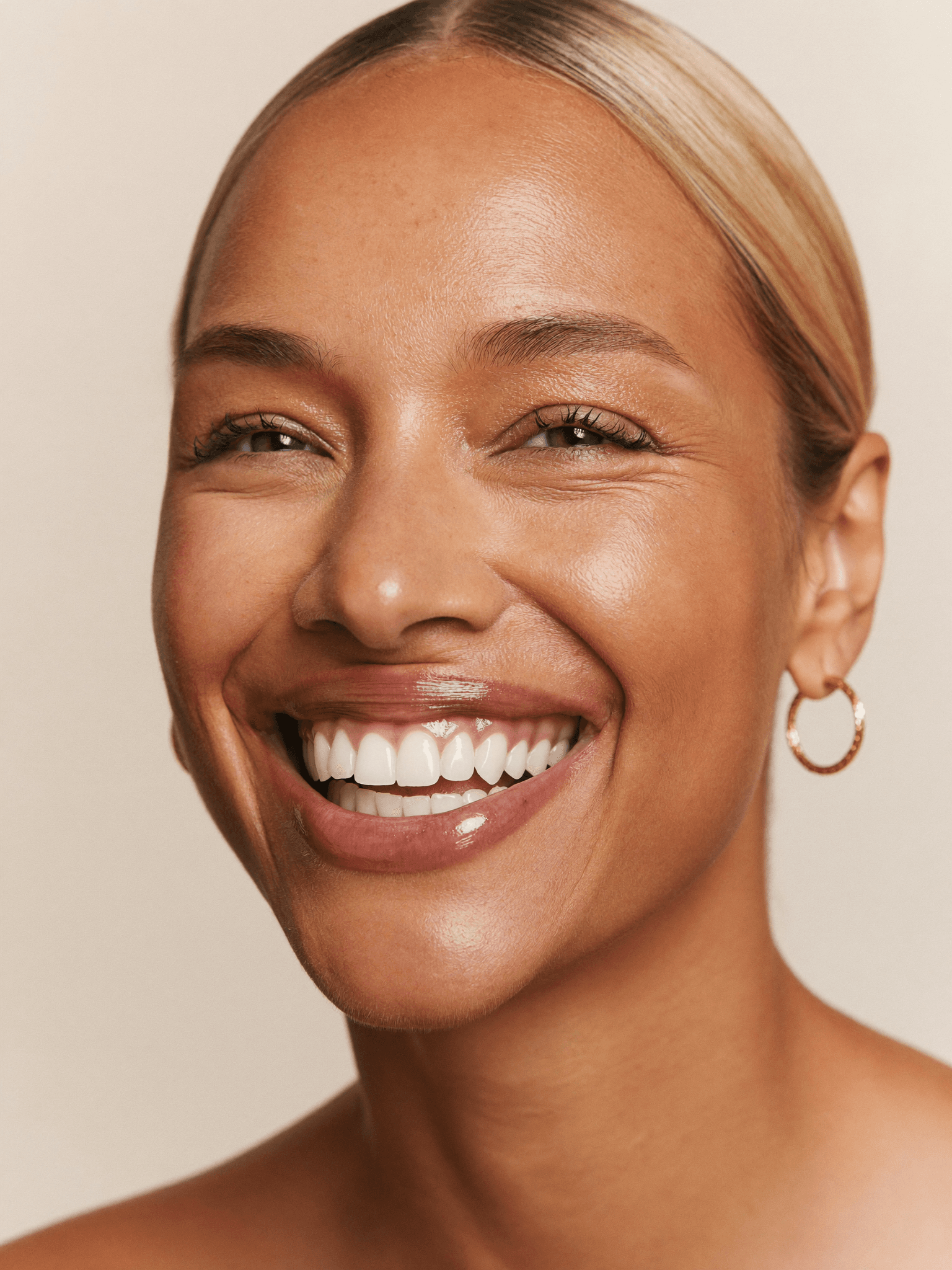 Blanqueamiento dental en Miami — sonrisa blanca radiante con brillo natural